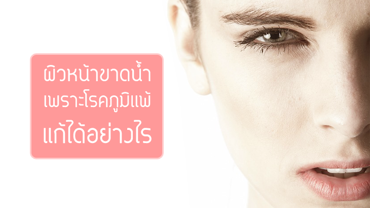 ผิวหน้าขาดน้ำ เพราะโรคภูมิเเพ้ผิวหนังพันธุกรรรมรักษายังไงดี?