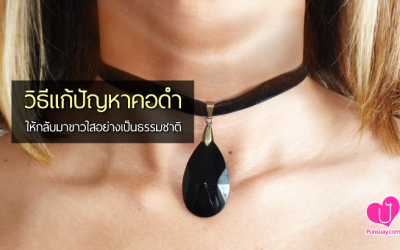 วิธีแก้ปัญหา “คอดำ” ให้กลับมาขาวใสอย่างเป็นธรรมชาติ