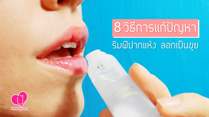 8 วิธีการแก้ปัญหา ” ริมฝีปากแห้ง ลอกเป็นขุย “