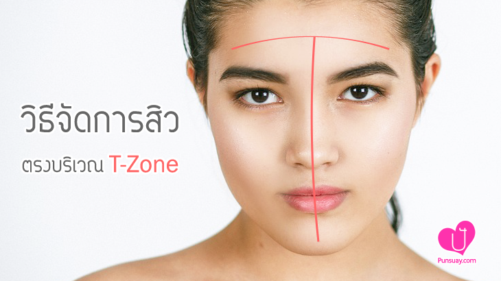 วิธีจัดการสิว ตรงบริเวณ T-Zone